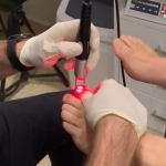 The current image has no alternative text. The file name is: Nail-Laser-Clinic-.png